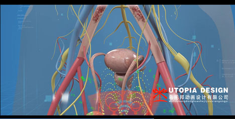 醫(yī)療醫(yī)學三維動畫項目制作—三維動畫烏托邦動畫